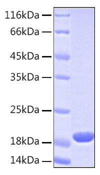 Recombinant Human UBE2L3 Protein was determined by SDS-PAGE under reducing conditions with Coomassie Blue.