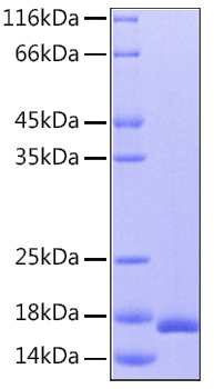Recombinant Human IL-36Ra/IL-1F5 Protein was determined by SDS-PAGE under reducing conditions with Coomassie Blue.