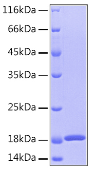 Recombinant Human GMF-Beta/GMFB Protein was determined by SDS-PAGE under reducing conditions with Coomassie Blue.