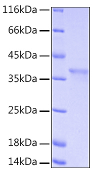 Recombinant Human IkB-alpha/NFKBIA Protein was determined by SDS-PAGE under reducing conditions with Coomassie Blue.
