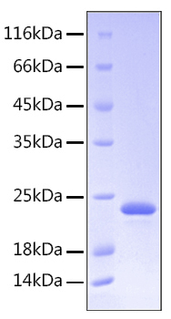 Recombinant Human Somatotropin/GH-N/GH1 Protein was determined by SDS-PAGE under reducing conditions with Coomassie Blue.