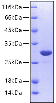 Recombinant Human Carbonic anhydrase 2 Protein was determined by SDS-PAGE under reducing conditions with Coomassie Blue.