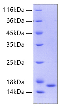 Recombinant Human IL-36 gamma/IL-1F9 Protein was determined by SDS-PAGE under reducing conditions with Coomassie Blue.