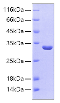 Recombinant Human Sulfotransferase 1A1/SULT1A1 Protein was determined by SDS-PAGE under reducing conditions with Coomassie Blue.