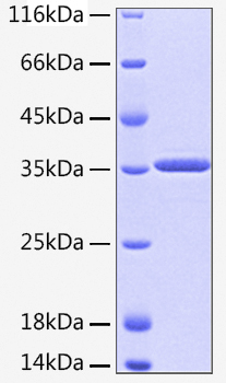 Recombinant Human HTRA2 Protein was determined by SDS-PAGE under reducing conditions with Coomassie Blue.