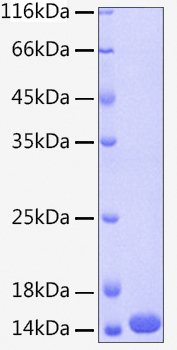 Recombinant Human Cystatin-A/CSTA Protein was determined by SDS-PAGE under reducing conditions with Coomassie Blue.