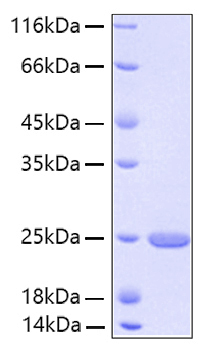 Recombinant Human FGF-21 Protein was determined by SDS-PAGE under reducing conditions with Coomassie Blue.