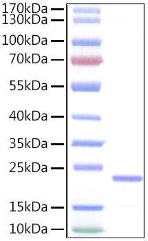 Recombinant Human IL-11 Protein was determined by SDS-PAGE under reducing conditions with Coomassie Blue.