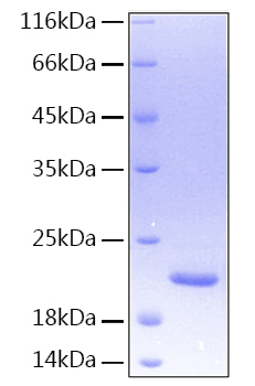Recombinant Human TNFSF15/TL1 Protein was determined by SDS-PAGE under reducing conditions with Coomassie Blue.