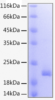 Recombinant Human TNFSF9/4-1BB Ligand Protein was determined by SDS-PAGE under reducing conditions with Coomassie Blue.