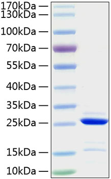 Recombinant Human Bcl-2 Protein was determined by SDS-PAGE under reducing conditions with Coomassie Blue.
