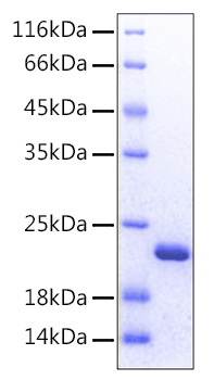 Recombinant Human FGF-12 Protein was determined by SDS-PAGE under reducing conditions with Coomassie Blue.