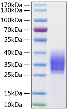 Recombinant Human PD-1/PDCD1/CD279 Protein was determined by SDS-PAGE under reducing conditions with Coomassie Blue.