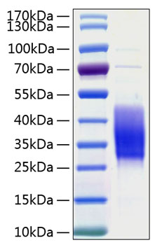 Recombinant Human TIM-3/HAVCR2/CD366 Protein was determined by SDS-PAGE under reducing conditions with Coomassie Blue.