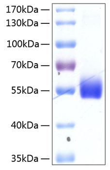 Recombinant Human TNFRSF14/HVEM/CD270 Protein was determined by SDS-PAGE under reducing conditions with Coomassie Blue.
