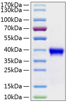 Recombinant Human R-spondin-1/RSPO1 Protein was determined by SDS-PAGE under reducing conditions with Coomassie Blue.