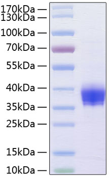 Recombinant Human Ep-CAM/TROP-1/CD326 Protein was determined by SDS-PAGE under reducing conditions with Coomassie Blue.