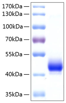 Recombinant Human ALK-4/ACVR1B Protein was determined by SDS-PAGE under reducing conditions with Coomassie Blue.