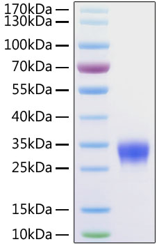 Recombinant Human Fc gamma RIIB/FCGR2B/CD32b Protein was determined by SDS-PAGE under reducing conditions with Coomassie Blue.