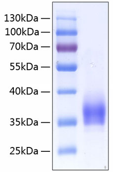 Recombinant Human IL-2RA/CD25 Protein was determined by SDS-PAGE under reducing conditions with Coomassie Blue.