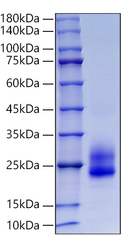 Recombinant Human CD69 Protein was determined by SDS-PAGE under reducing conditions with Coomassie Blue.