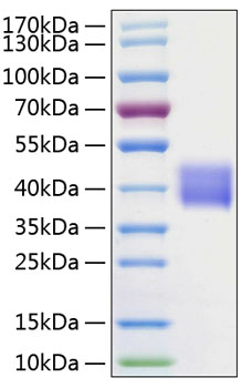 Recombinant Human Kallikrein-1/KLK1 Protein was determined by SDS-PAGE under reducing conditions with Coomassie Blue.