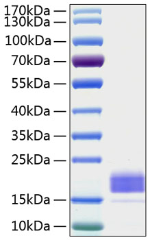 Recombinant Human TIGIT Protein was determined by SDS-PAGE under reducing conditions with Coomassie Blue.