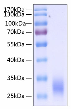 Recombinant Human Fc gamma RIIA/FCGR2A/CD32a (H167R) Protein was determined by SDS-PAGE under reducing conditions with Coomassie Blue.