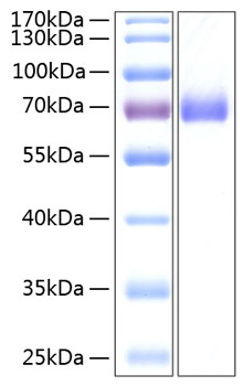 Recombinant Human EphA2/ECK Protein was determined by SDS-PAGE under reducing conditions with Coomassie Blue.