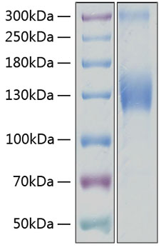 Recombinant Human VEGFR-2/KDR/CD309 Protein was determined by SDS-PAGE under reducing conditions with Coomassie Blue.