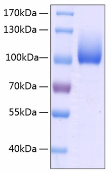 Recombinant Human LIMP II/SCARB2/CD36L2 Protein was determined by SDS-PAGE under reducing conditions with Coomassie Blue.
