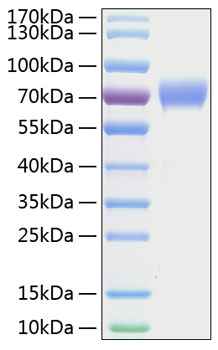 Recombinant Human Tyrosine-protein kinase receptor UFO/Axl Protein was determined by SDS-PAGE under reducing conditions with Coomassie Blue.