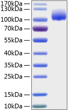 Recombinant Human Trk-A/NTRK1 Protein was determined by SDS-PAGE under reducing conditions with Coomassie Blue.