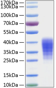 Recombinant Human Leukemia inhibitory factor/LIF Protein was determined by SDS-PAGE under reducing conditions with Coomassie Blue.