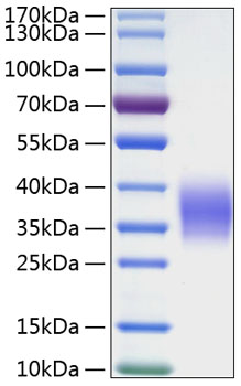 Recombinant Human Ephrin-B2/EFNB2 Protein was determined by SDS-PAGE under reducing conditions with Coomassie Blue.