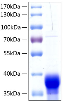 Recombinant Human Ephrin-B1/EFNB1 Protein was determined by SDS-PAGE under reducing conditions with Coomassie Blue.