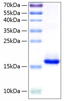 Recombinant Human IL-10 Protein was determined by SDS-PAGE under reducing conditions with Coomassie Blue.