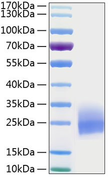Recombinant Human CSF-2/GM-CSF Protein was determined by SDS-PAGE under reducing conditions with Coomassie Blue.