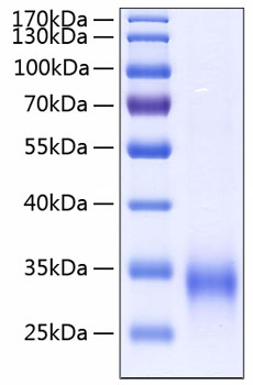 Recombinant Human MBP-C/MBL-2 Protein was determined by SDS-PAGE under reducing conditions with Coomassie Blue.