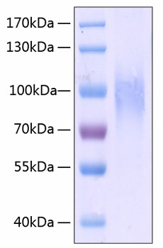Recombinant Human PECAM-1/CD31 Protein was determined by SDS-PAGE under reducing conditions with Coomassie Blue.