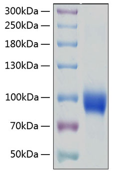 Recombinant Human IL-18R1/CD218a Protein was determined by SDS-PAGE under reducing conditions with Coomassie Blue.