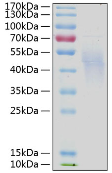 Recombinant Human IL-4R alpha/CD124 Protein was determined by SDS-PAGE under reducing conditions with Coomassie Blue.
