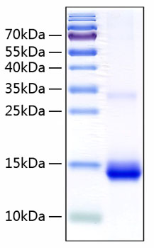 Recombinant Human Cystatin-SN/CST1 Protein was determined by SDS-PAGE under reducing conditions with Coomassie Blue.