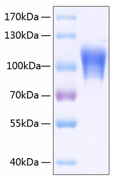 Recombinant Human MCAM/CD146 Protein was determined by SDS-PAGE under reducing conditions with Coomassie Blue.