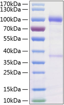 Recombinant Human GDNFR-alpha-1/GFRA1 Protein was determined by SDS-PAGE under reducing conditions with Coomassie Blue.