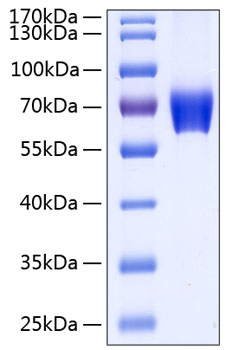 Recombinant Human Basigin/EMMPRIN/CD147 Protein was determined by SDS-PAGE under reducing conditions with Coomassie Blue.