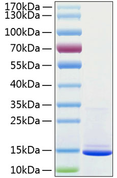 Recombinant Human Beta-2-microglobulin/B2M Protein was determined by SDS-PAGE under reducing conditions with Coomassie Blue.