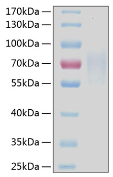 Recombinant Human TNFRSF8/CD30 Protein was determined by SDS-PAGE under reducing conditions with Coomassie Blue.