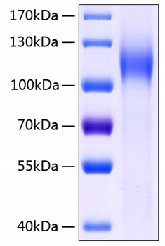 Recombinant Human CDH17/LI-cadherin Protein was determined by SDS-PAGE under reducing conditions with Coomassie Blue.
