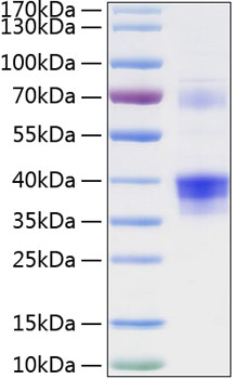 Recombinant Human Clusterin/Apo-J/CLU Protein was determined by SDS-PAGE under reducing conditions with Coomassie Blue.